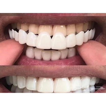 EJVS™  Dental Snap Smile Teeth Cover Perfect Smile Veneers - Comfort Fit Flex Whitening Dentures