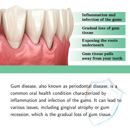EJVS™  Gum Repair Drops Relieve Receding Gingival Gum - Oral Periodontal Hygiene