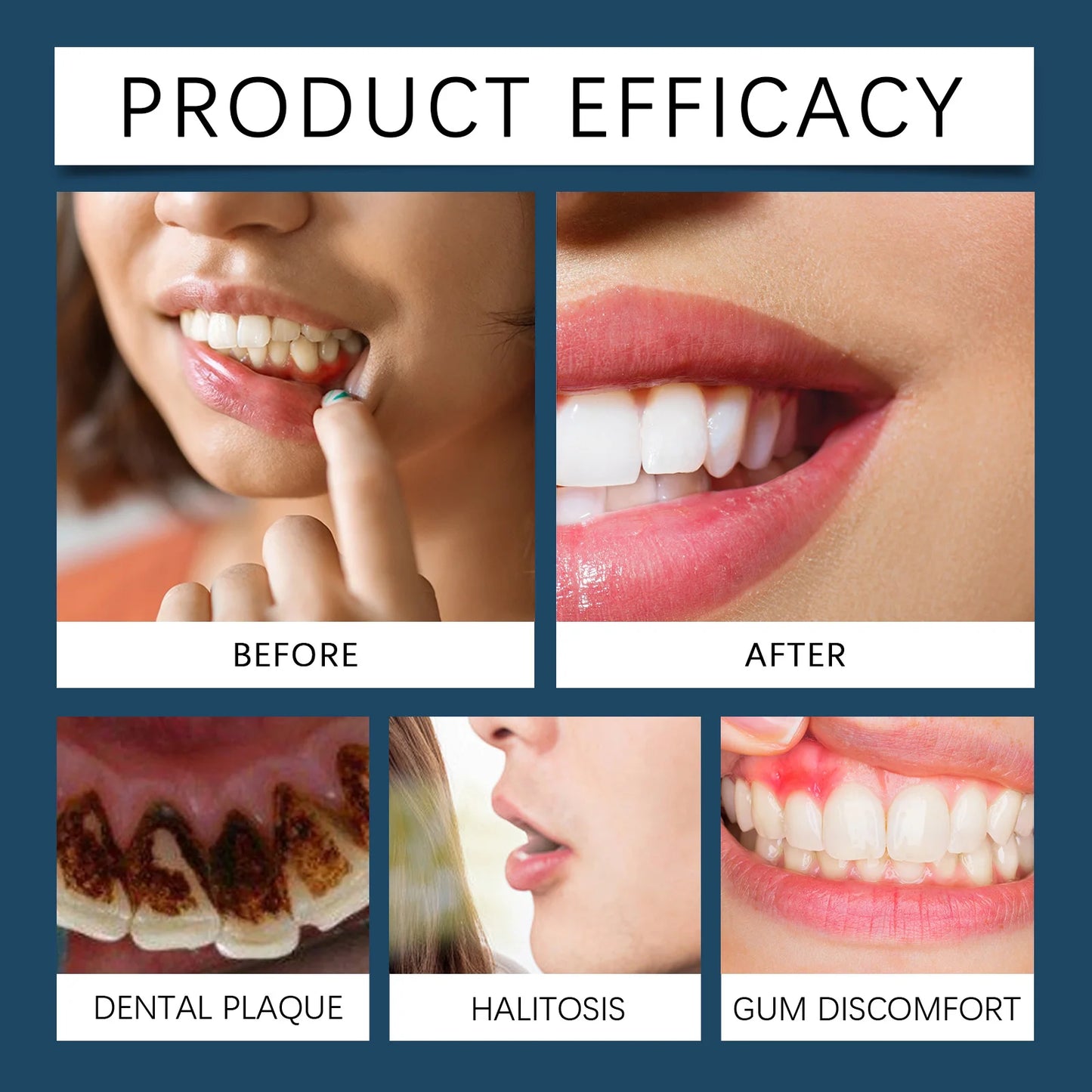 EJVS™  Rapid Gums Repair Gel Tooth Allergy Reliever Tooth Damage Serum