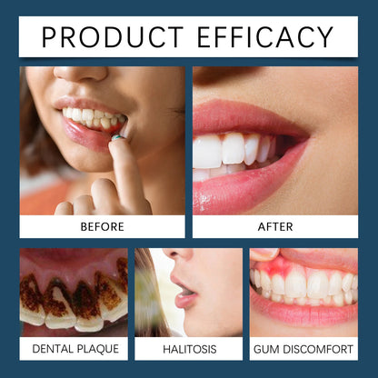 EJVS™  Rapid Gums Repair Gel Tooth Allergy Reliever Tooth Damage Serum