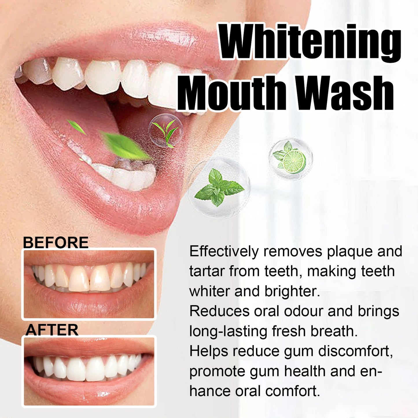 EJVS™  Gum Repair Drops Relieve Receding Gingival Gum - Oral Periodontal Hygiene