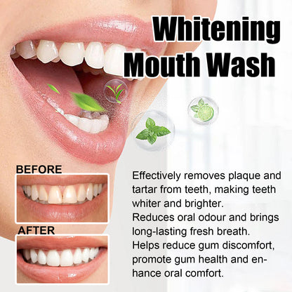 EJVS™  Gum Repair Drops Relieve Receding Gingival Gum - Oral Periodontal Hygiene