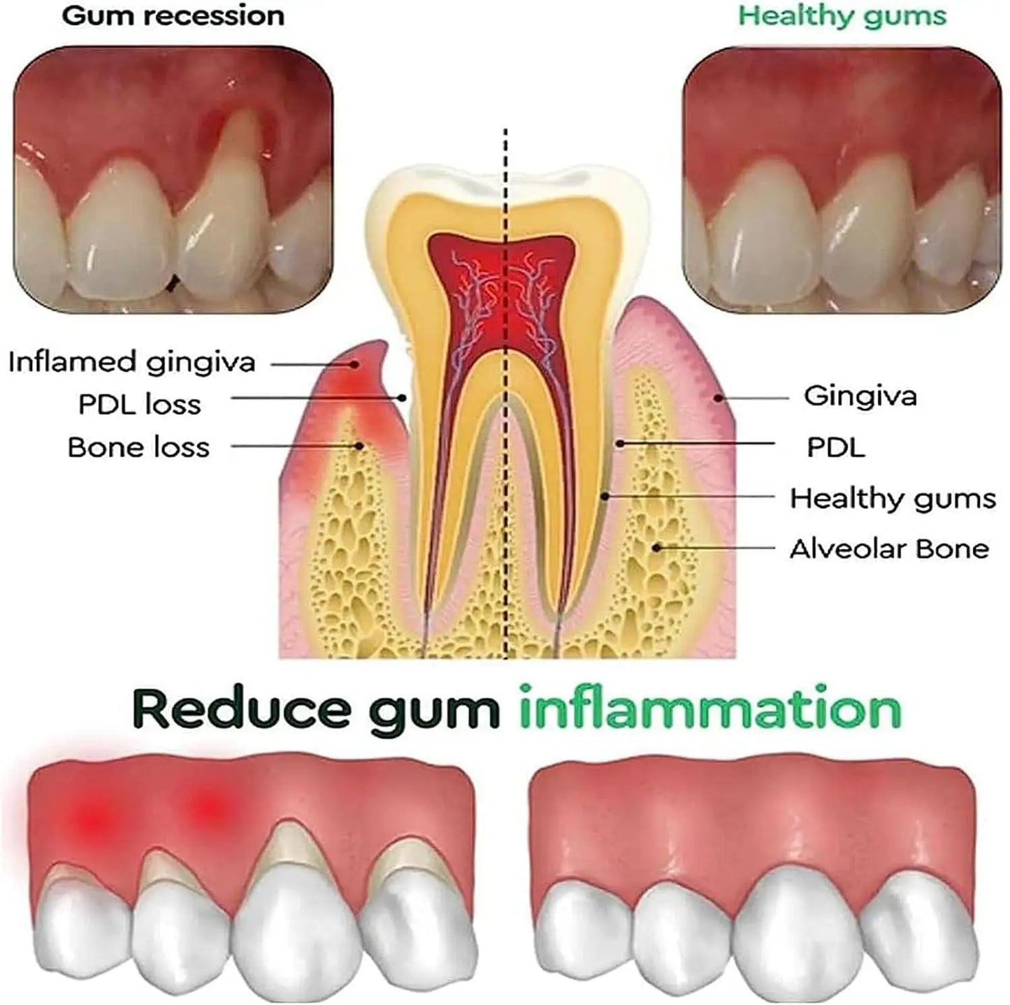 EJVS™  Rapid Gums Repair Gel Tooth Allergy Reliever Tooth Damage Serum
