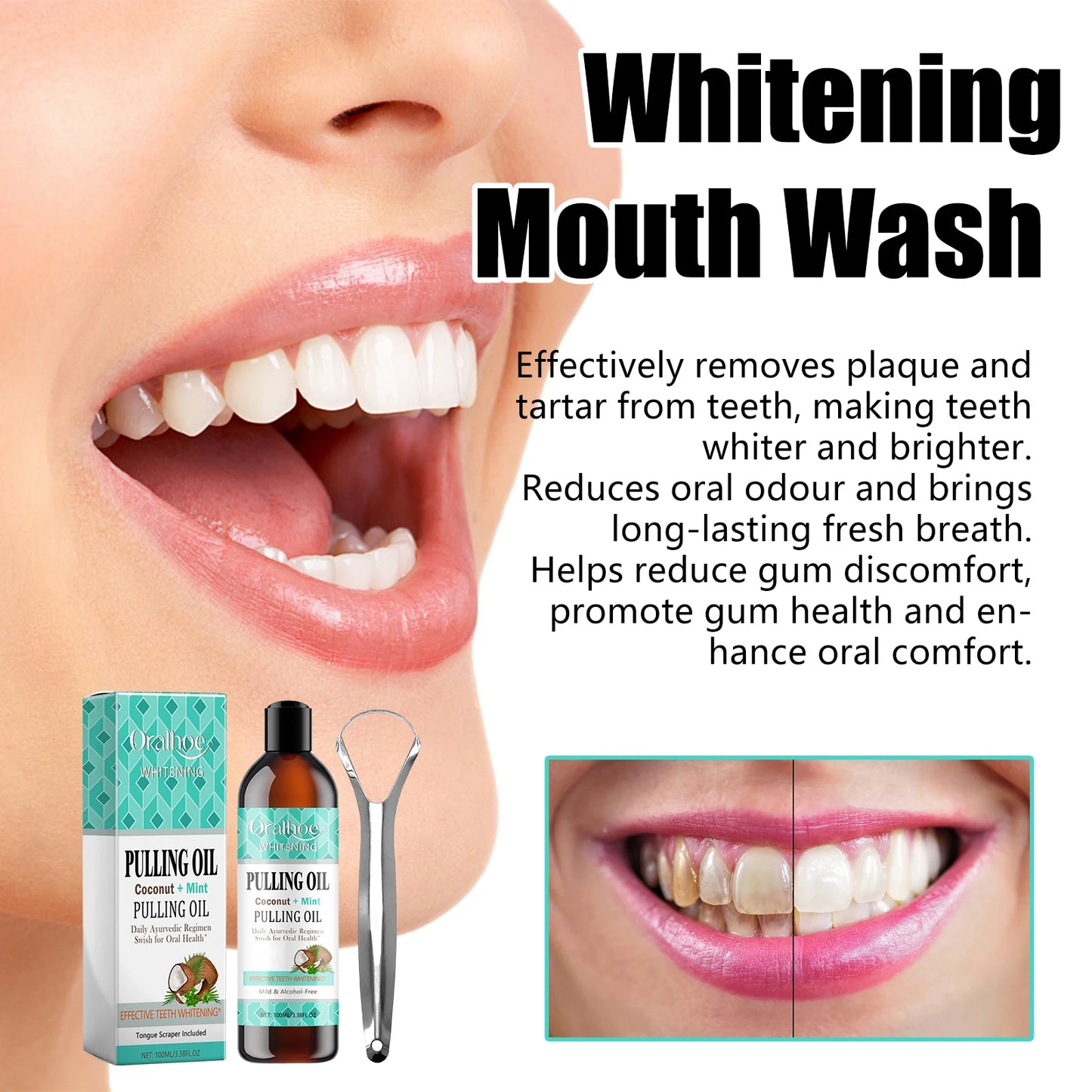 EJVS™  Gum Repair Drops Relieve Receding Gingival Gum - Oral Periodontal Hygiene