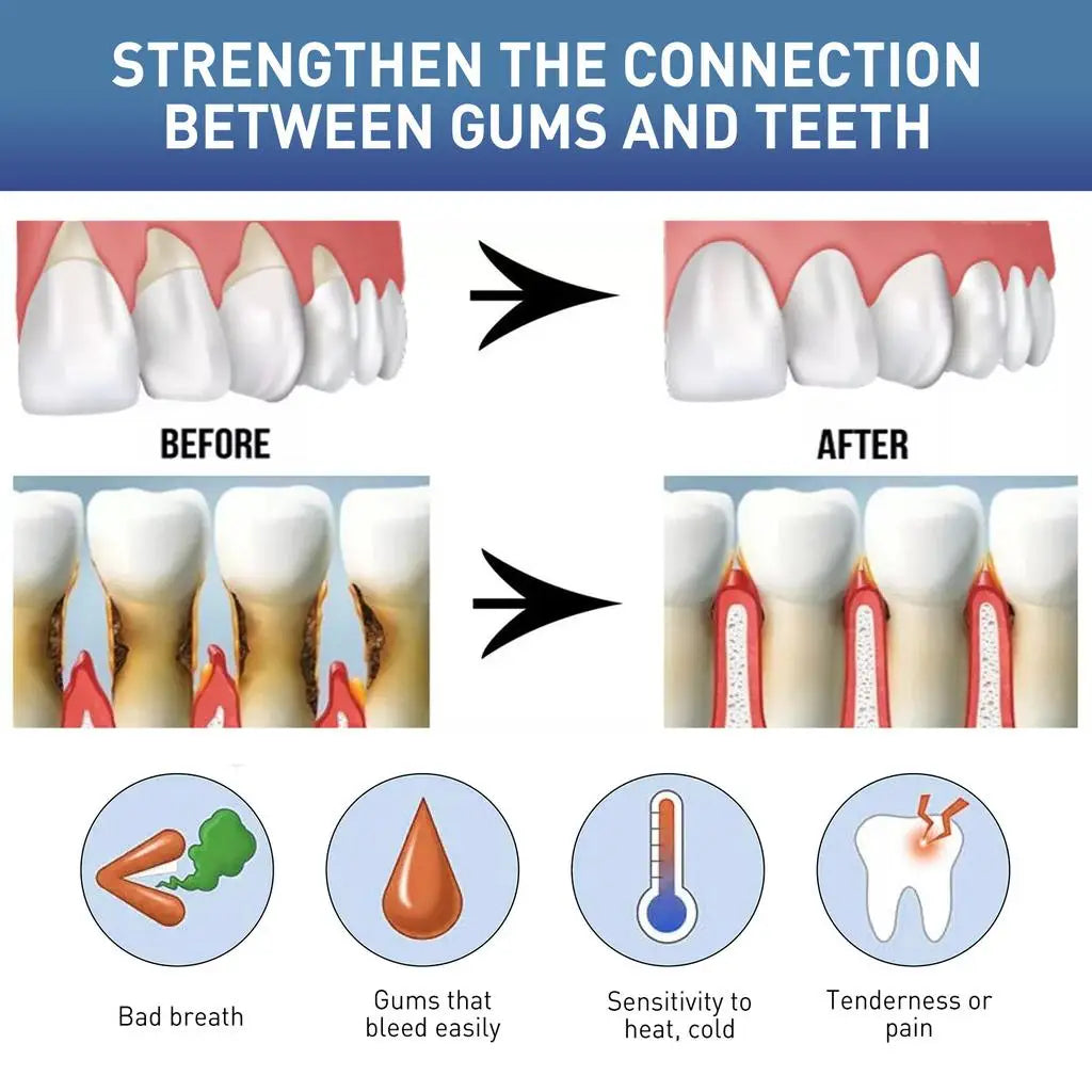 EJVS™  Rapid Gums Repair Gel Tooth Allergy Reliever Tooth Damage Serum